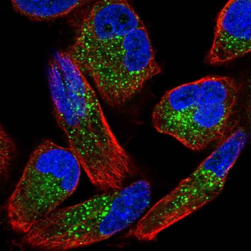 ZNF624 Antibody - BSA Free Immunocytochemistry/ Immunofluorescence: ZNF624 Antibody [NBP2-48561]