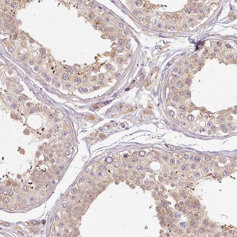 RB1CC1 Antibody - BSA Free Immunohistochemistry: RB1CC1 Antibody - BSA Free [NBP2-48572]