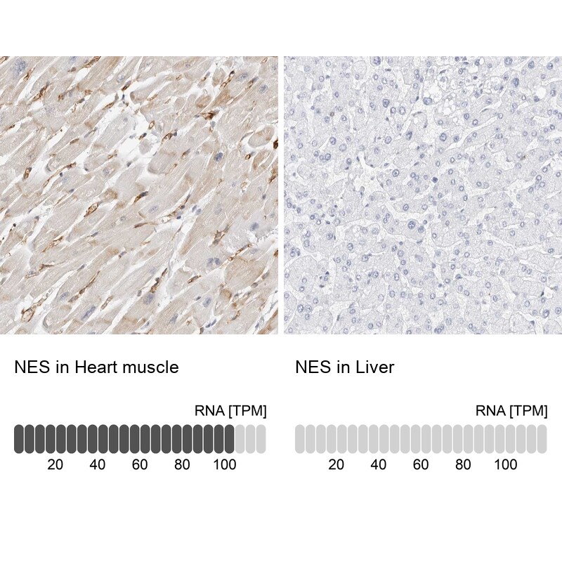 Nestin Antibody - BSA Free Immunohistochemistry-Paraffin: Nestin Antibody [NBP2-48575]