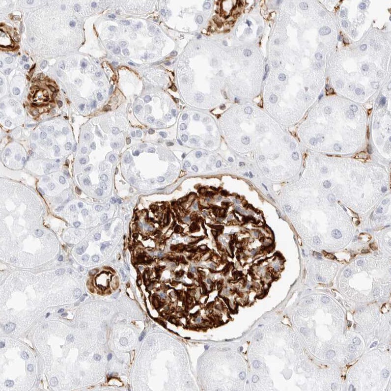 Nestin Antibody - BSA Free Immunohistochemistry-Paraffin: Nestin Antibody [NBP2-48575]