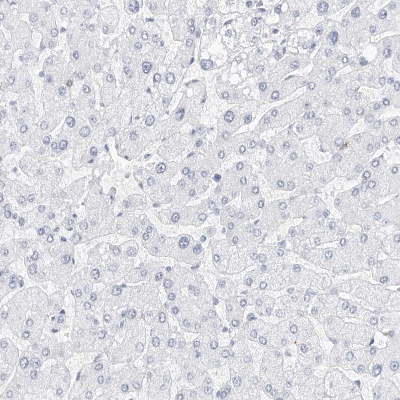 Nestin Antibody - BSA Free Immunohistochemistry-Paraffin: Nestin Antibody [NBP2-48575]