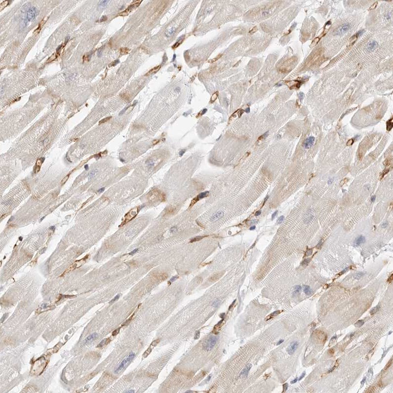 Nestin Antibody - BSA Free Immunohistochemistry-Paraffin: Nestin Antibody [NBP2-48575]