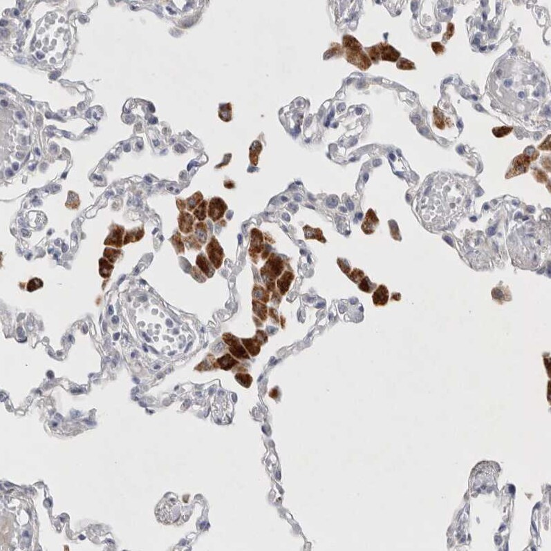LYAG/GAA Antibody - BSA Free Immunohistochemistry-Paraffin: LYAG/GAA Antibody - BSA Free [NBP2-48576]
