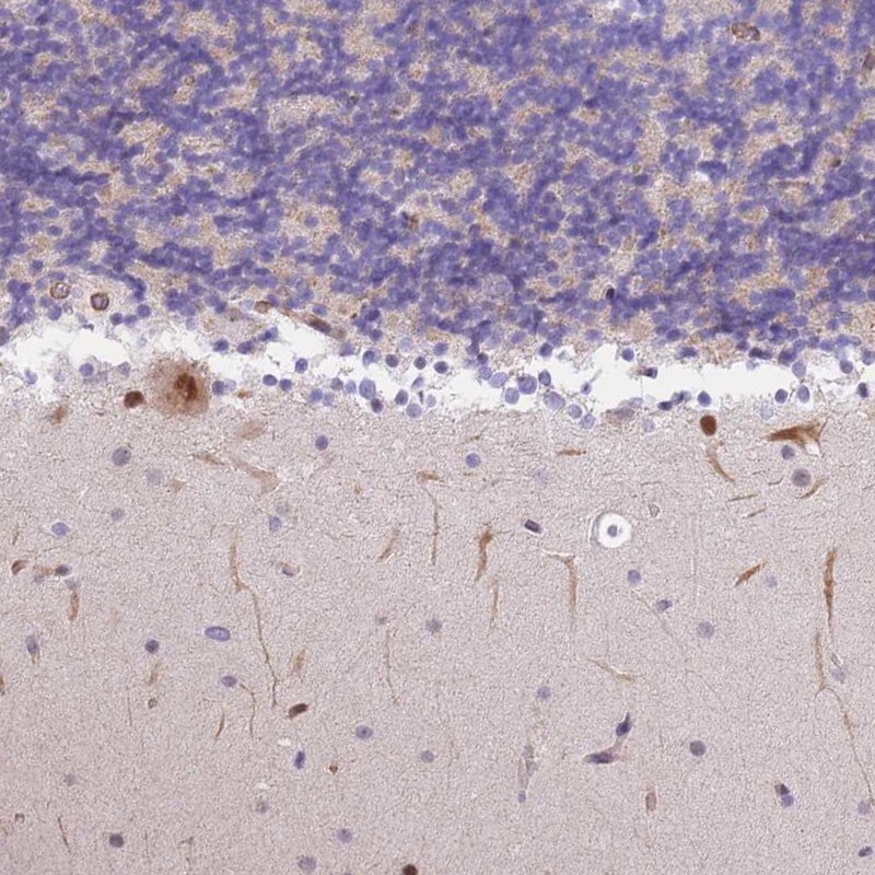 S100P binding protein Antibody - BSA Free Immunohistochemistry-Paraffin: S100P binding protein Antibody [NBP2-48580]