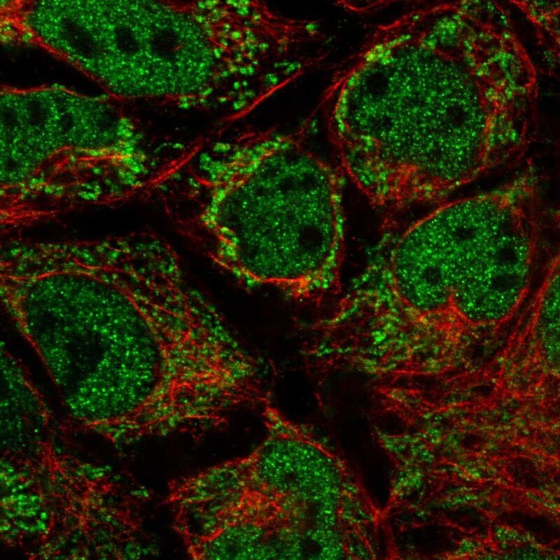 MRPL10 Antibody - BSA Free Immunocytochemistry/ Immunofluorescence: MRPL10 Antibody [NBP2-48590]