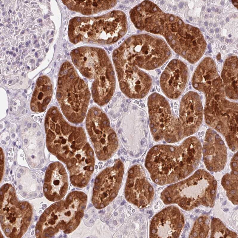 58K Golgi Protein Antibody - BSA Free Immunohistochemistry-Paraffin: 58K Golgi Protein Antibody [NBP2-48601]