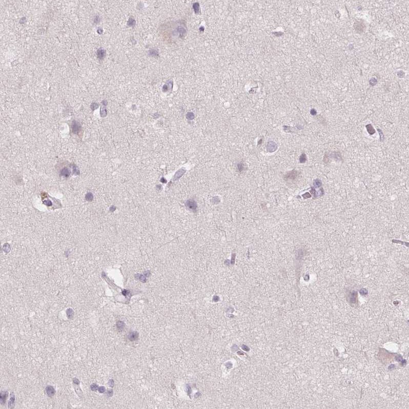 58K Golgi Protein Antibody - BSA Free Immunohistochemistry-Paraffin: 58K Golgi Protein Antibody [NBP2-48601]