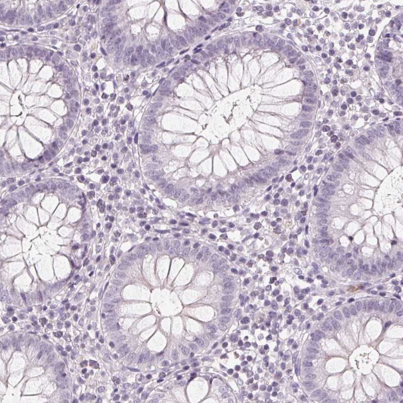 58K Golgi Protein Antibody - BSA Free Immunohistochemistry-Paraffin: 58K Golgi Protein Antibody [NBP2-48601]