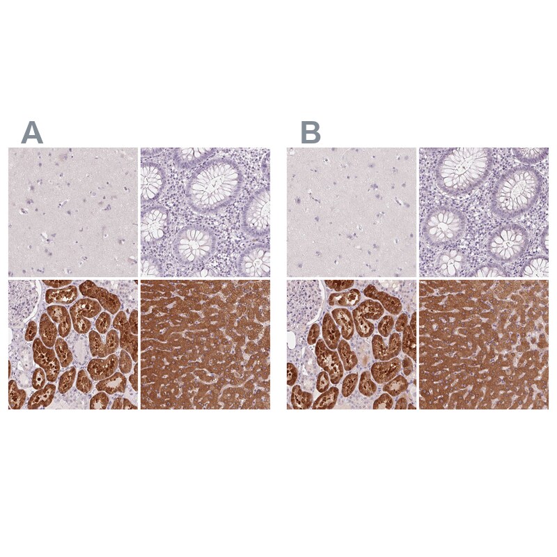 58K Golgi Protein Antibody - BSA Free Immunohistochemistry-Paraffin: 58K Golgi Protein Antibody [NBP2-48601]