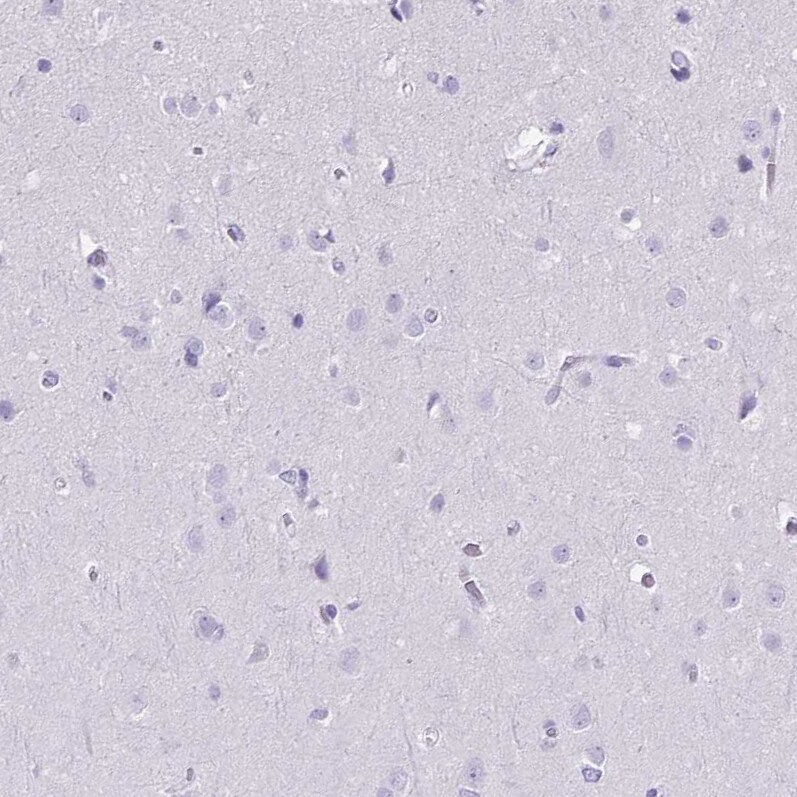 Galectin-4 Antibody - BSA Free Immunohistochemistry-Paraffin: Galectin-4 Antibody [NBP2-48606]