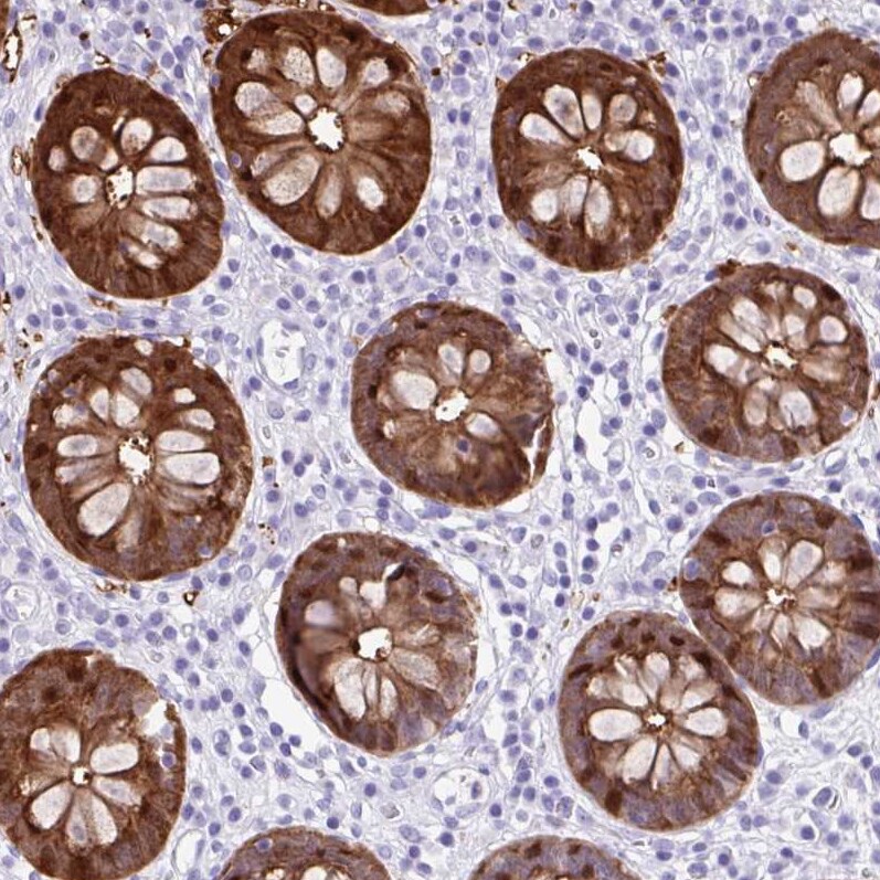 Galectin-4 Antibody - BSA Free Immunohistochemistry-Paraffin: Galectin-4 Antibody [NBP2-48606]