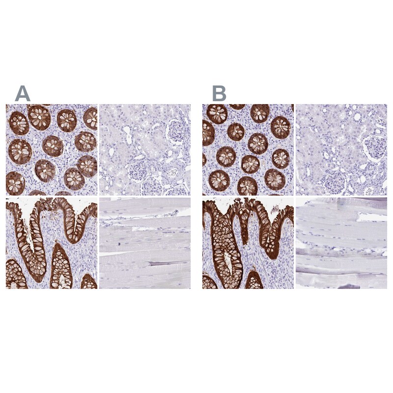 Galectin-4 Antibody - BSA Free Immunohistochemistry-Paraffin: Galectin-4 Antibody [NBP2-48606]
