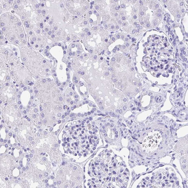 Galectin-4 Antibody - BSA Free Immunohistochemistry-Paraffin: Galectin-4 Antibody [NBP2-48606]