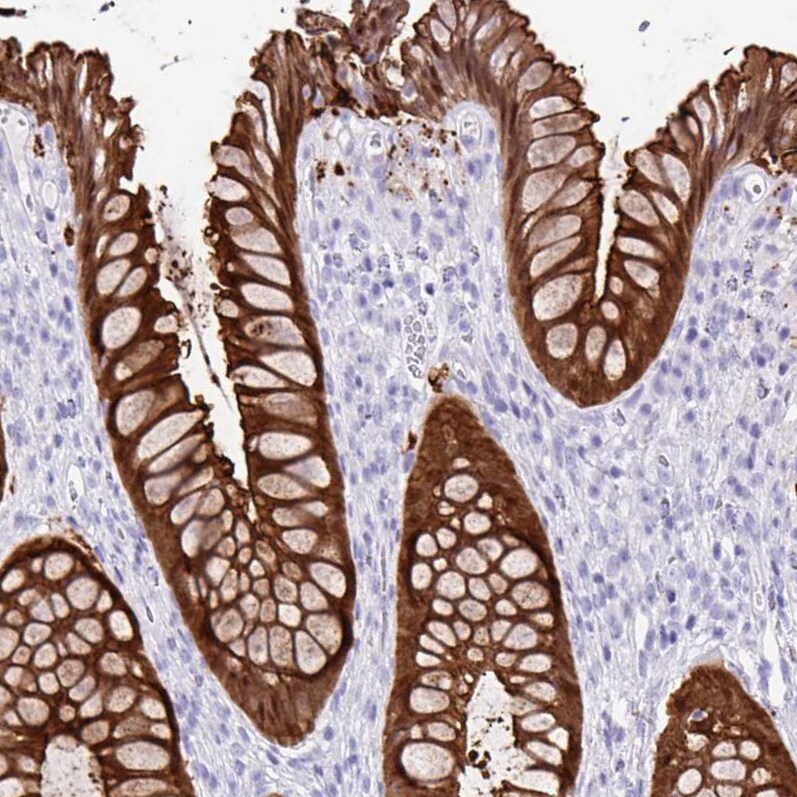 Galectin-4 Antibody - BSA Free Immunohistochemistry-Paraffin: Galectin-4 Antibody [NBP2-48606]