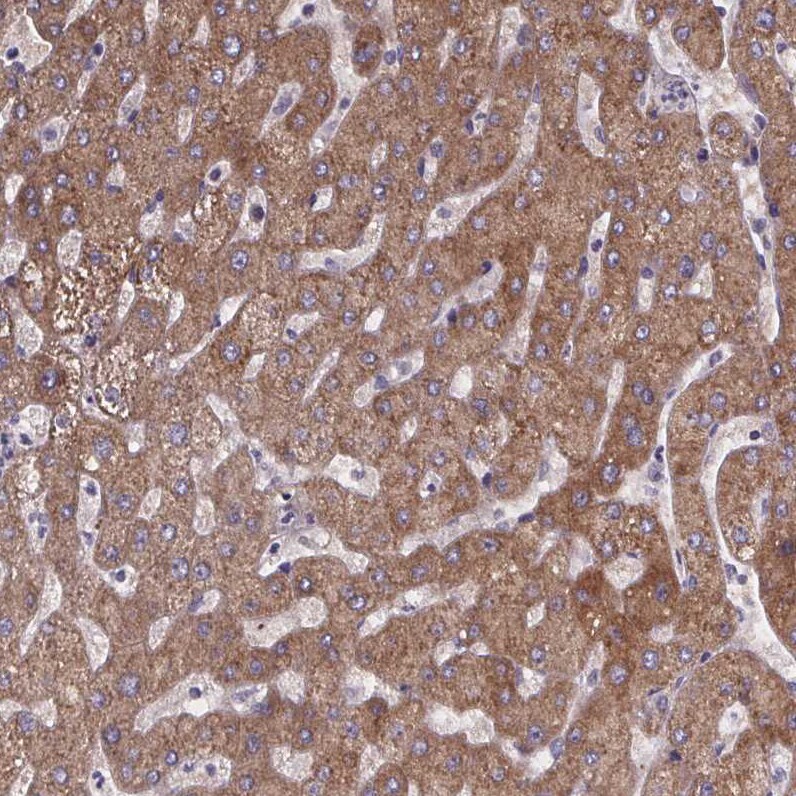 Phenylalanine Hydroxylase Antibody - BSA Free Immunohistochemistry-Paraffin: Phenylalanine Hydroxylase Antibody [NBP2-48615]