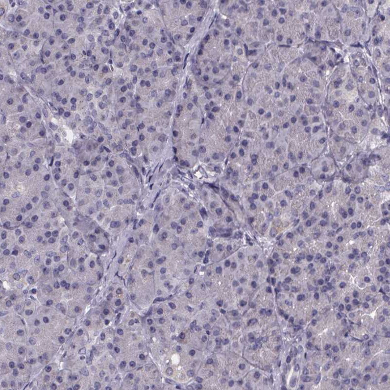 Phenylalanine Hydroxylase Antibody - BSA Free Immunohistochemistry-Paraffin: Phenylalanine Hydroxylase Antibody [NBP2-48615]