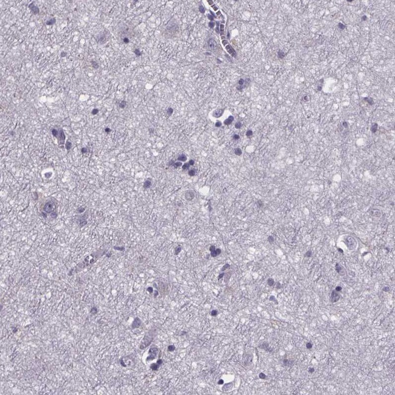 Phenylalanine Hydroxylase Antibody - BSA Free Immunohistochemistry-Paraffin: Phenylalanine Hydroxylase Antibody [NBP2-48615]
