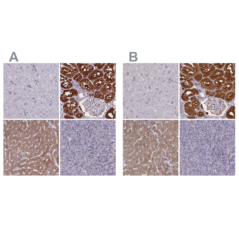 Phenylalanine Hydroxylase Antibody - BSA Free Immunohistochemistry-Paraffin: Phenylalanine Hydroxylase Antibody [NBP2-48615]