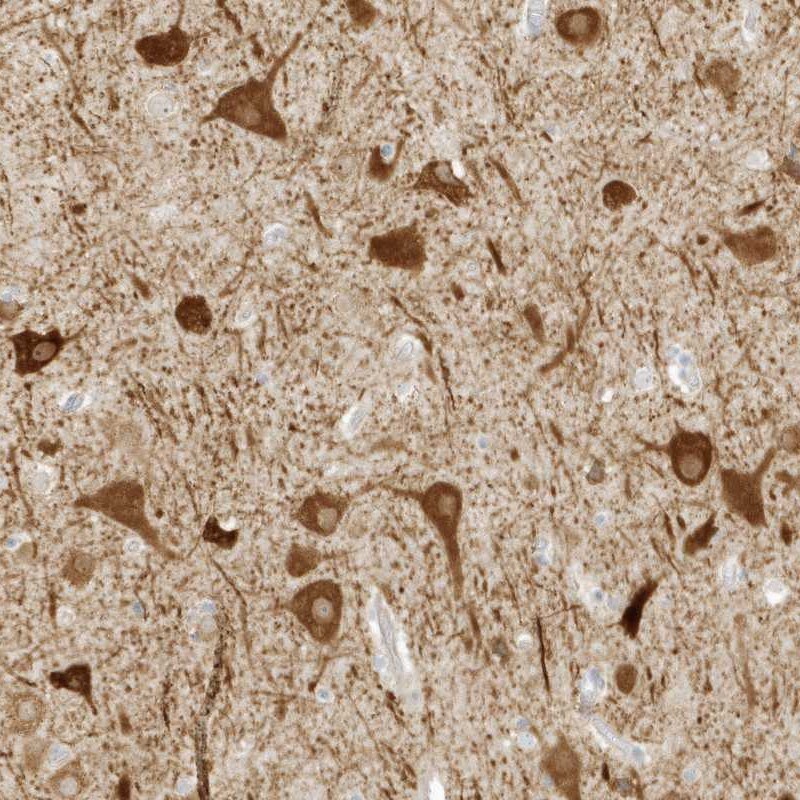 ZBTB8A Antibody - BSA Free Immunohistochemistry-Paraffin: ZBTB8A Antibody [NBP2-48619]