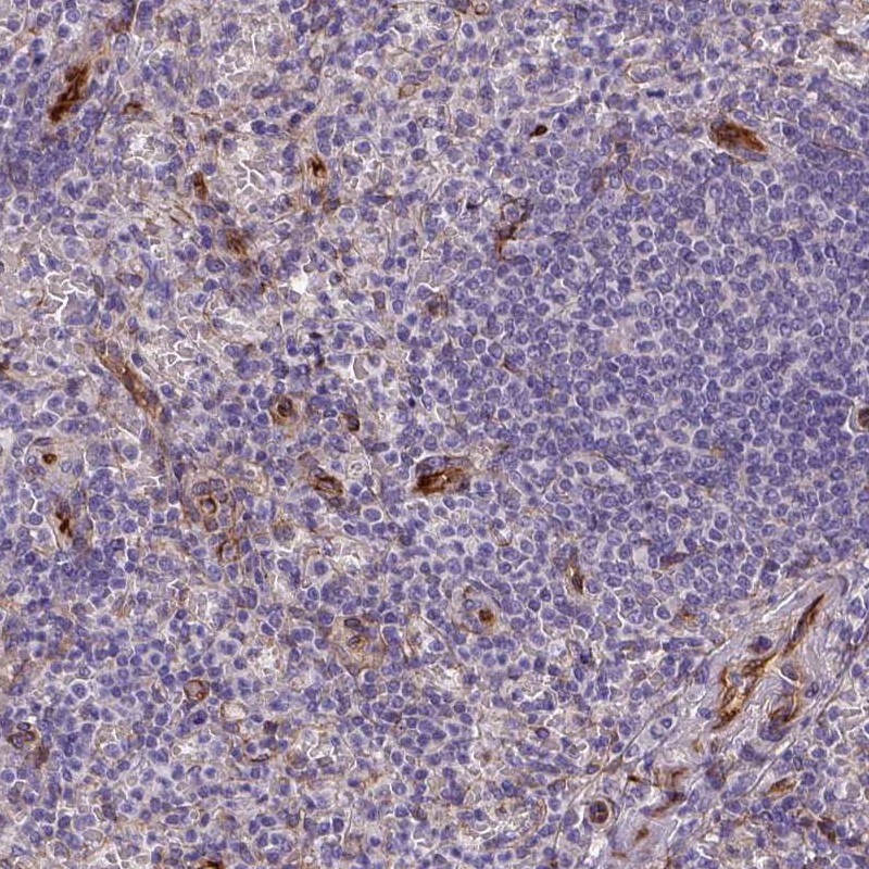 Kazrin Antibody - BSA Free Immunohistochemistry-Paraffin: Kazrin Antibody [NBP2-48622]