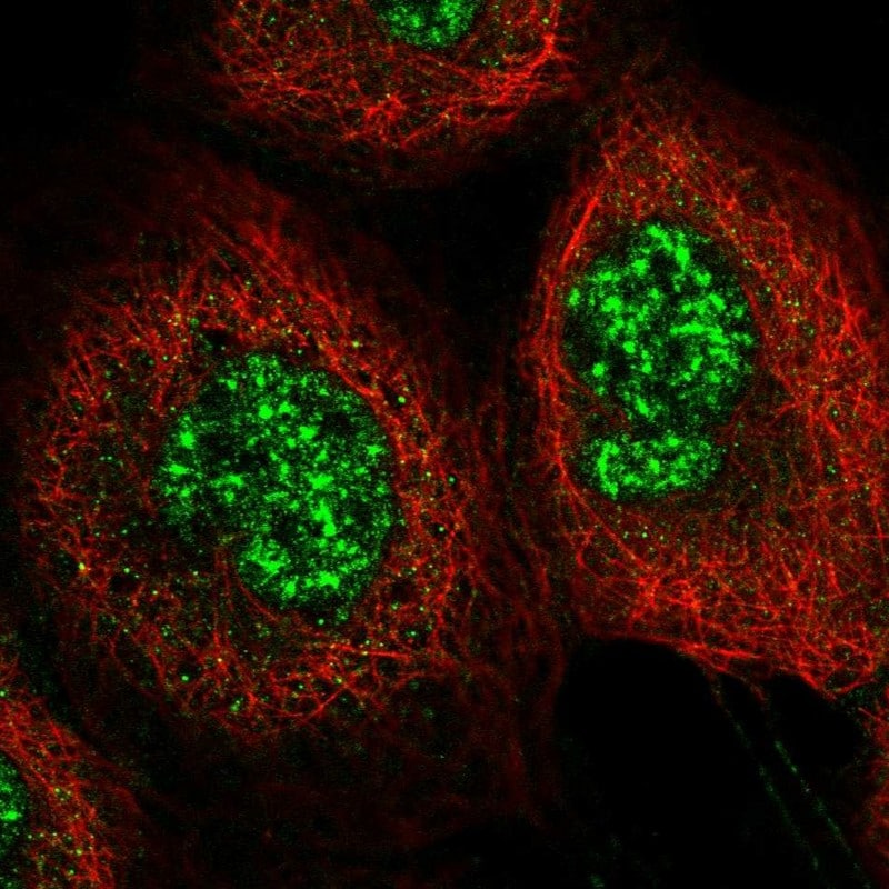C6orf106 Antibody - BSA Free Immunocytochemistry/ Immunofluorescence: C6orf106 Antibody [NBP2-48623]