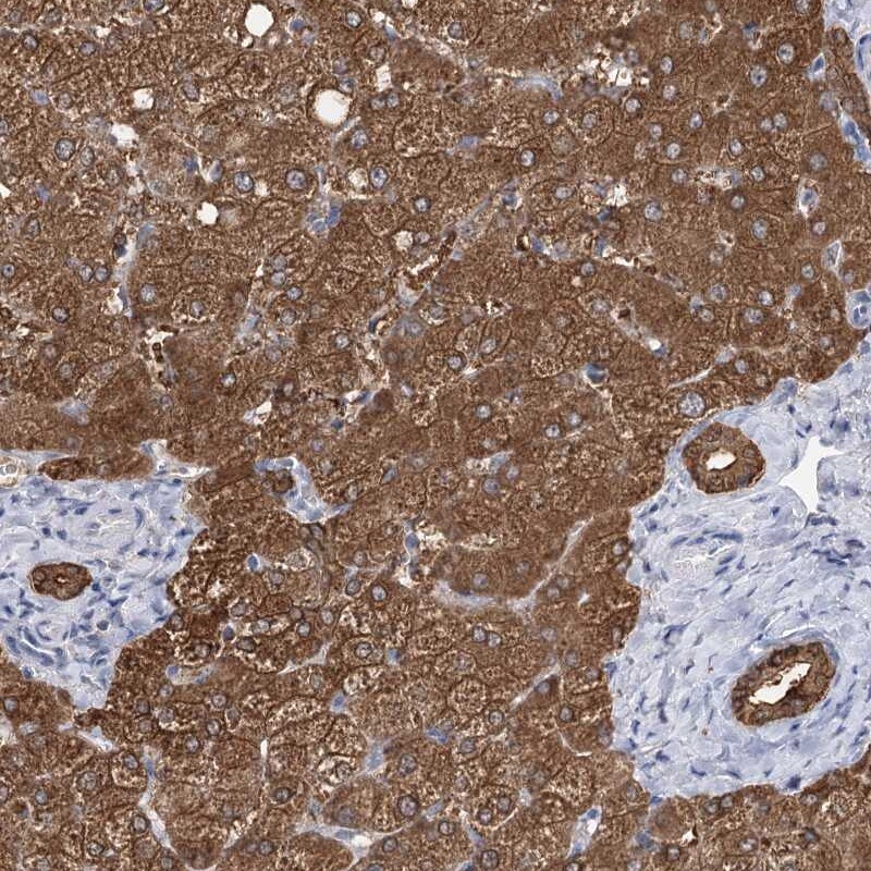 UGP2 Antibody - BSA Free Immunohistochemistry-Paraffin: UGP2 Antibody [NBP2-48625]