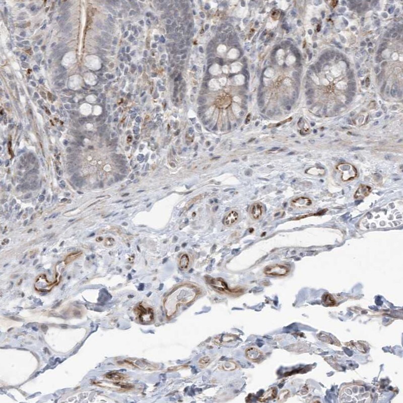 ADAMTSL3 Antibody - BSA Free Immunohistochemistry: ADAMTSL3 Antibody - BSA Free [NBP2-48627]