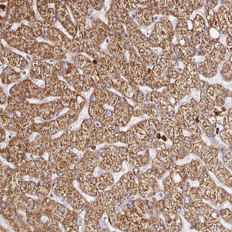 PDK-1 Antibody - BSA Free Immunohistochemistry: PDK-1 Antibody - BSA Free [NBP2-48631]