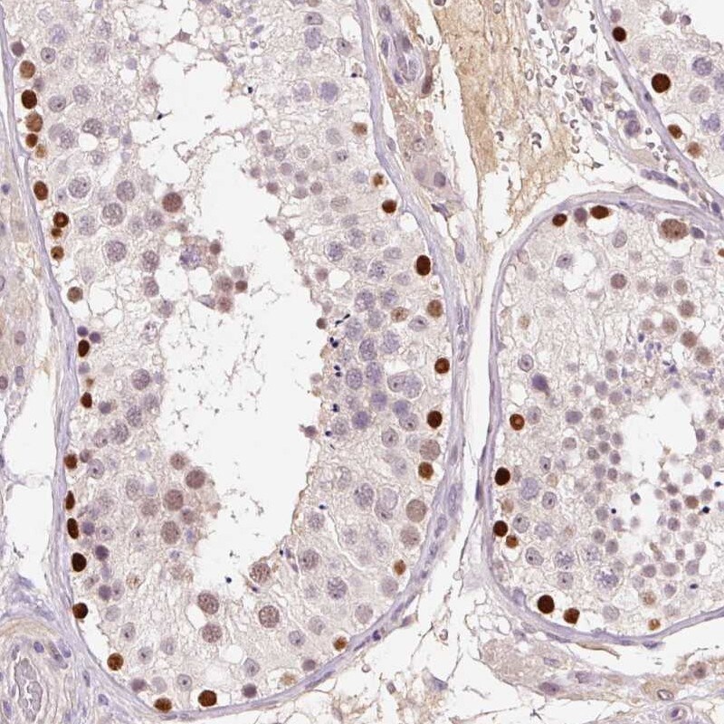 DPPA4 Antibody - BSA Free Immunohistochemistry-Paraffin: DPPA4 Antibody [NBP2-48633]