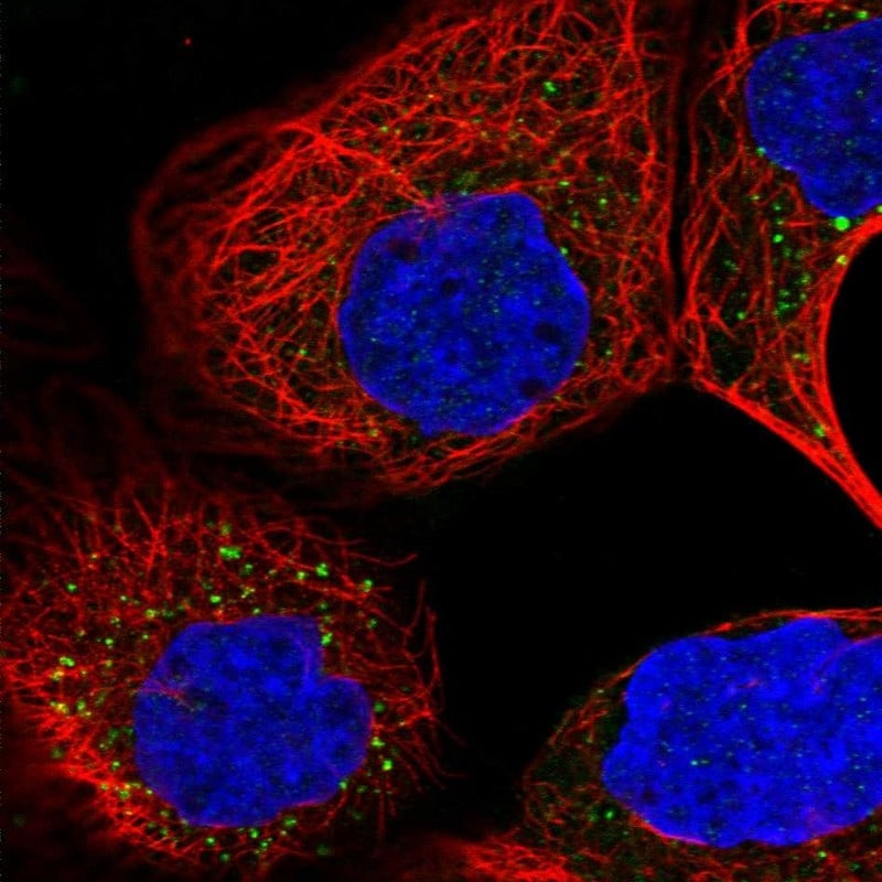 ARV1 Antibody - BSA Free Immunocytochemistry/ Immunofluorescence: ARV1 Antibody [NBP2-48641]