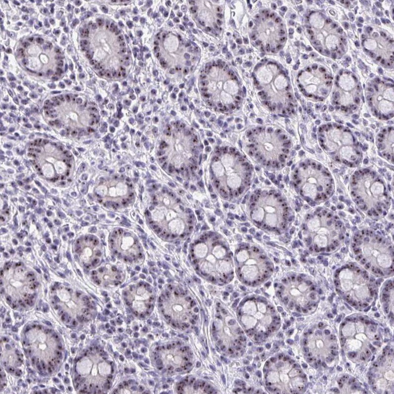 NIFK Antibody - BSA Free Immunohistochemistry-Paraffin: NIFK Antibody [NBP2-48642]