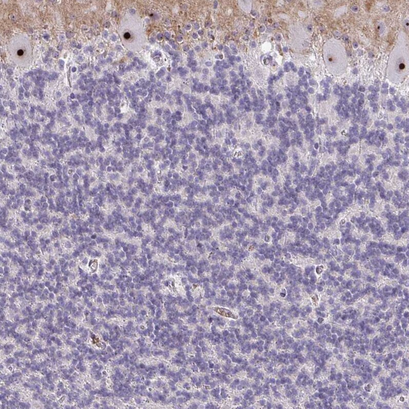 NIFK Antibody - BSA Free Immunohistochemistry-Paraffin: NIFK Antibody [NBP2-48642]