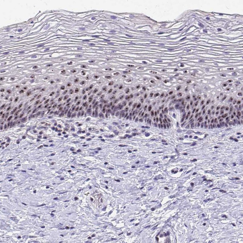 NIFK Antibody - BSA Free Immunohistochemistry-Paraffin: NIFK Antibody [NBP2-48642]