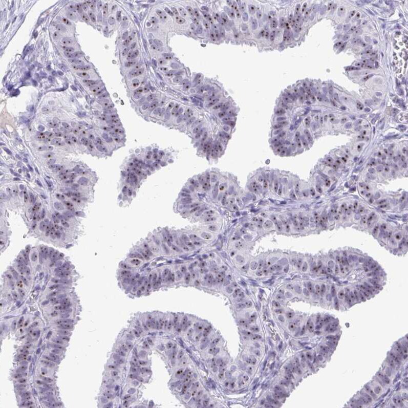NIFK Antibody - BSA Free Immunohistochemistry-Paraffin: NIFK Antibody [NBP2-48642]