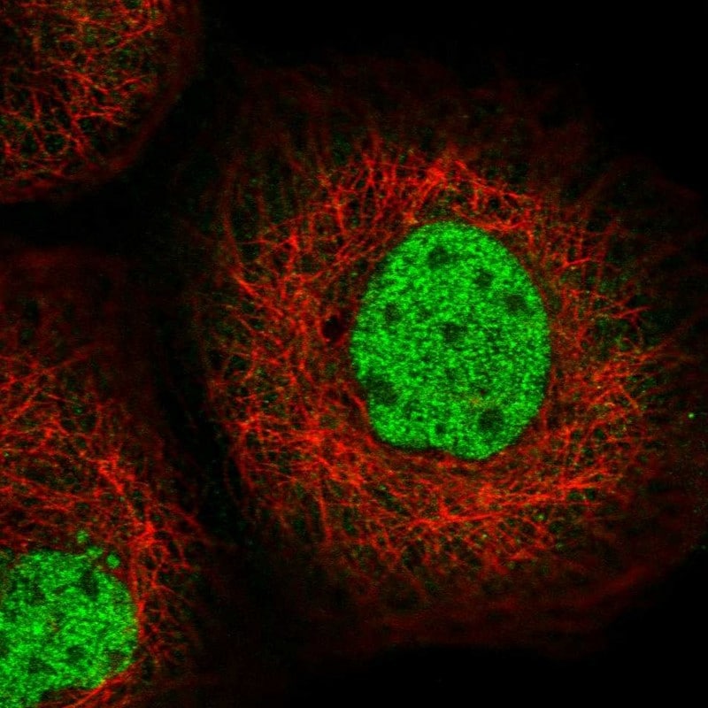 SFMBT1 Antibody - BSA Free Immunocytochemistry/ Immunofluorescence: SFMBT1 Antibody - BSA Free [NBP2-48652]