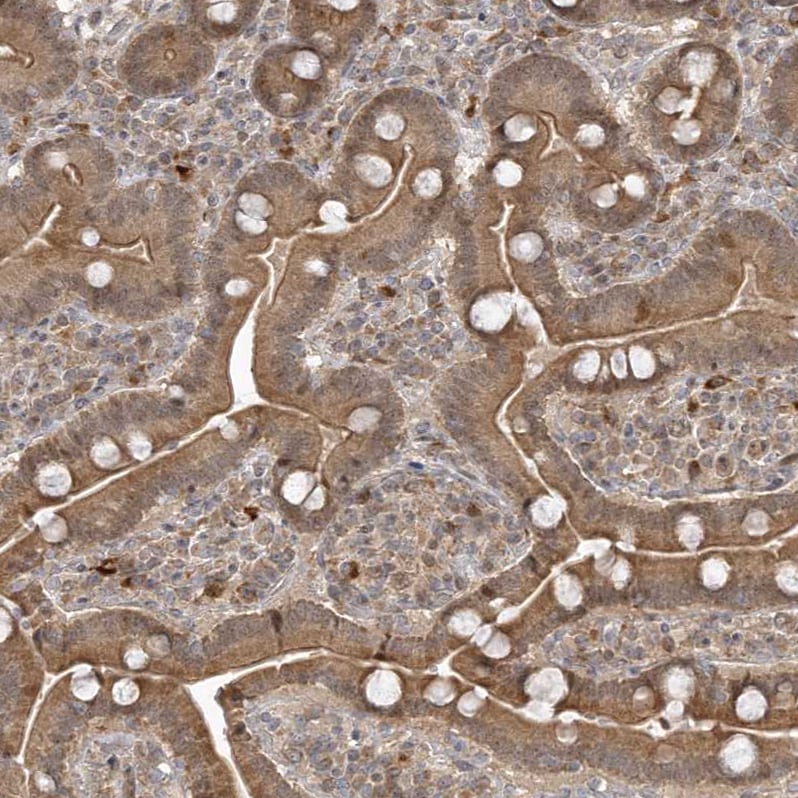 TRAIP Antibody - BSA Free Immunohistochemistry: TRAIP Antibody - BSA Free [NBP2-48655]