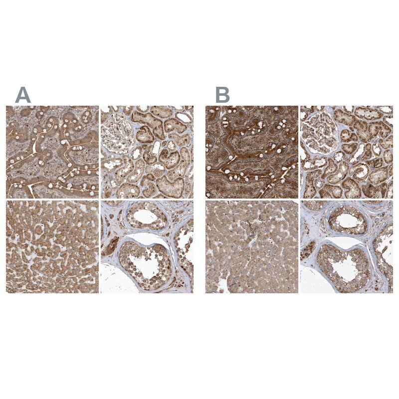 TRAIP Antibody - BSA Free Immunohistochemistry: TRAIP Antibody - BSA Free [NBP2-48655]