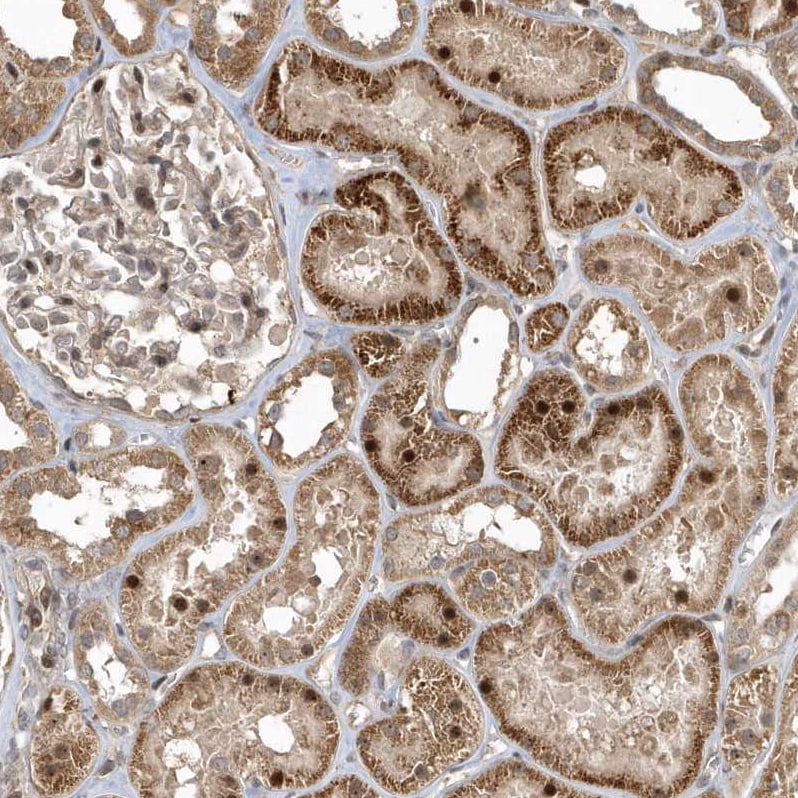 TRAIP Antibody - BSA Free Immunohistochemistry: TRAIP Antibody - BSA Free [NBP2-48655]