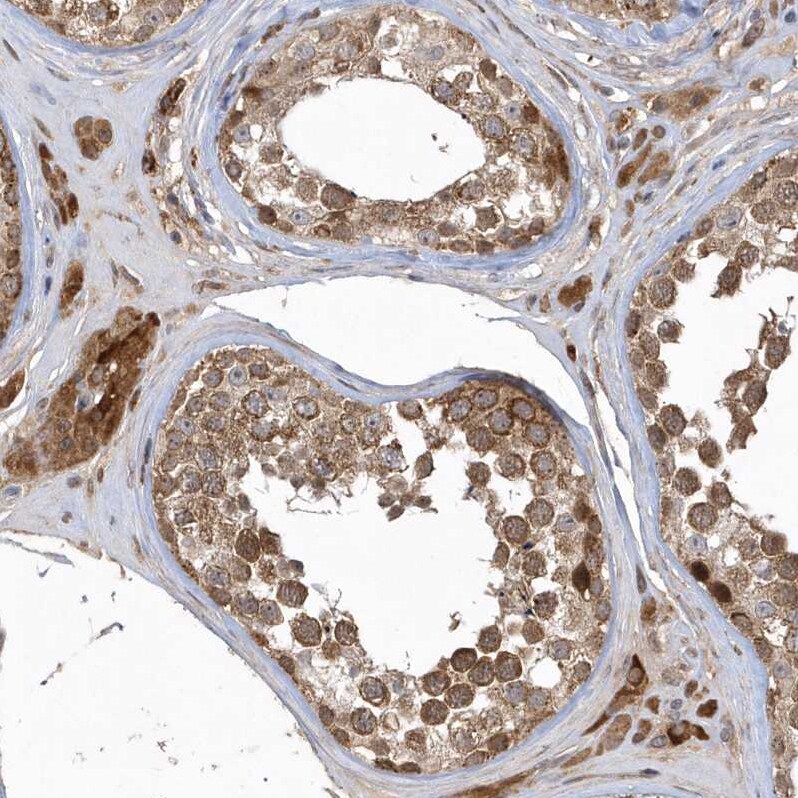 TRAIP Antibody - BSA Free Immunohistochemistry: TRAIP Antibody - BSA Free [NBP2-48655]
