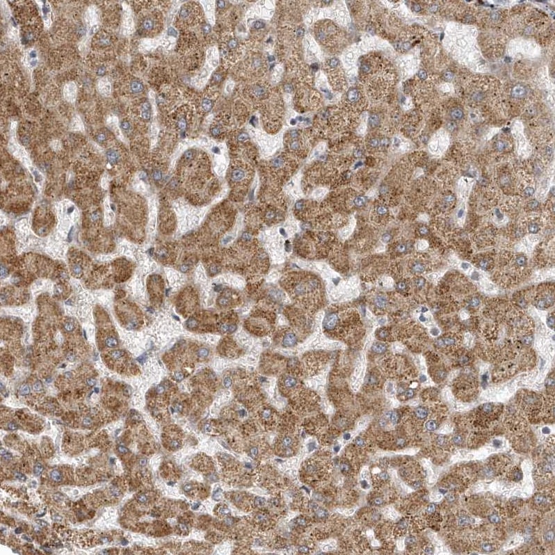 TRAIP Antibody - BSA Free Immunohistochemistry: TRAIP Antibody - BSA Free [NBP2-48655]