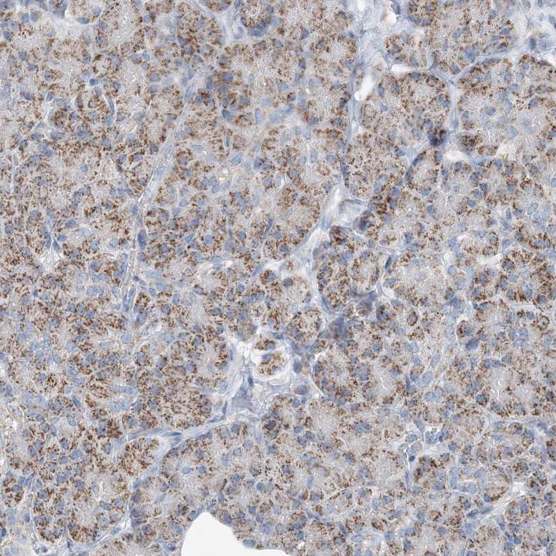 INTU Antibody - BSA Free Immunohistochemistry: INTU Antibody - BSA Free [NBP2-48663]