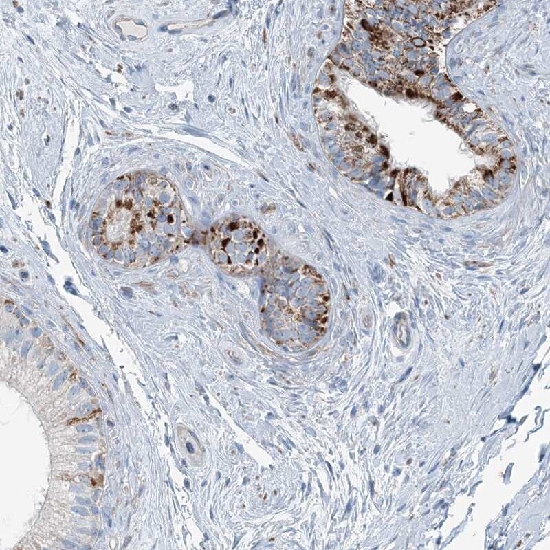 INTU Antibody - BSA Free Immunohistochemistry: INTU Antibody - BSA Free [NBP2-48663]