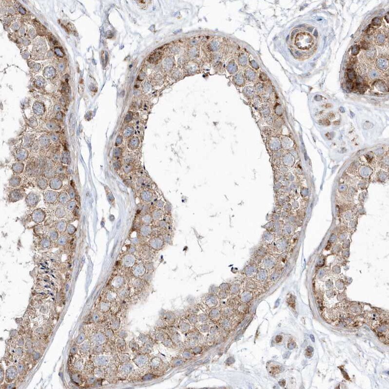 OPA1 Antibody - BSA Free Immunohistochemistry-Paraffin: OPA1 Antibody [NBP2-48669]