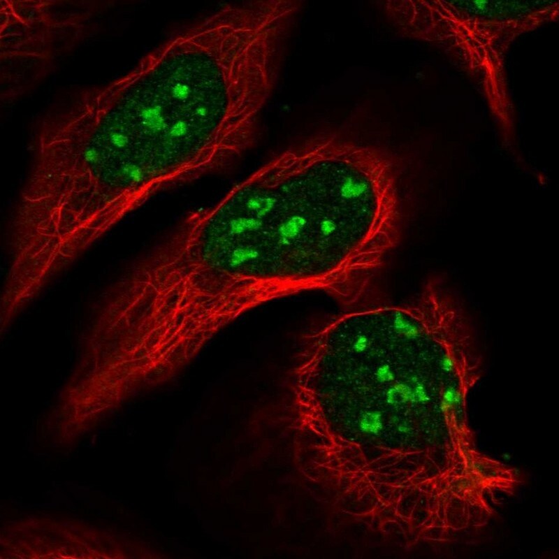 Dnmt2 Antibody - BSA Free Immunocytochemistry/ Immunofluorescence: Dnmt2 Antibody [NBP2-48670]