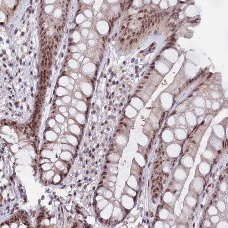 C1D Antibody - BSA Free Immunohistochemistry-Paraffin: C1D Antibody [NBP2-48673]
