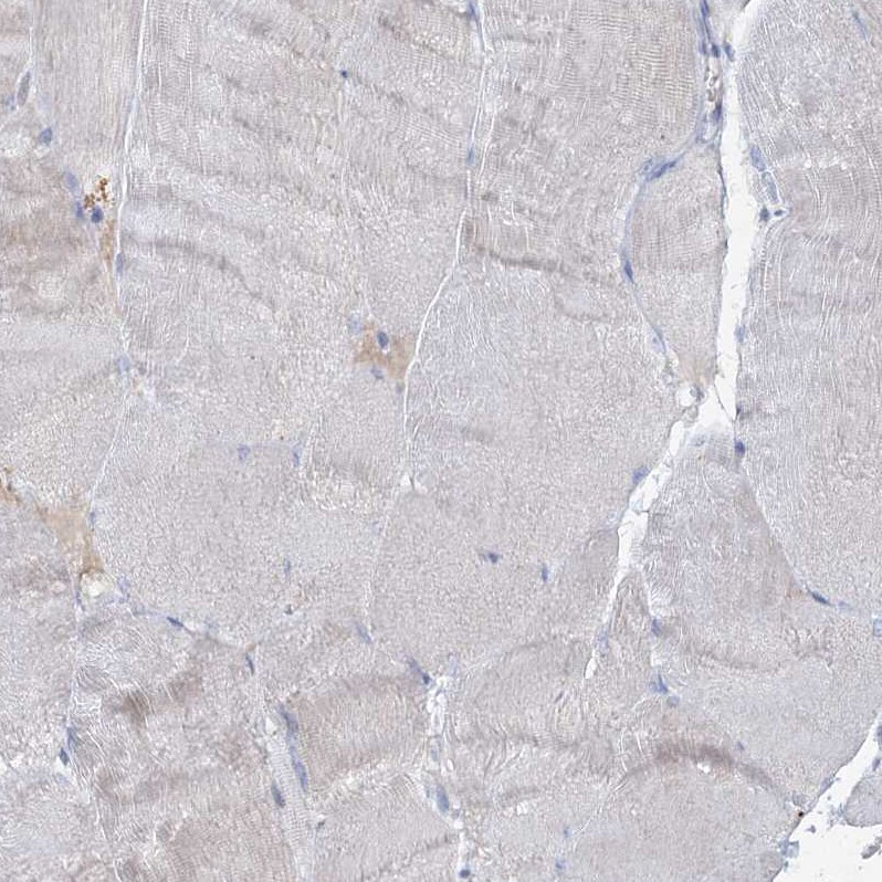 RFX6 Antibody - BSA Free Immunohistochemistry-Paraffin: RFX6 Antibody [NBP2-48677]
