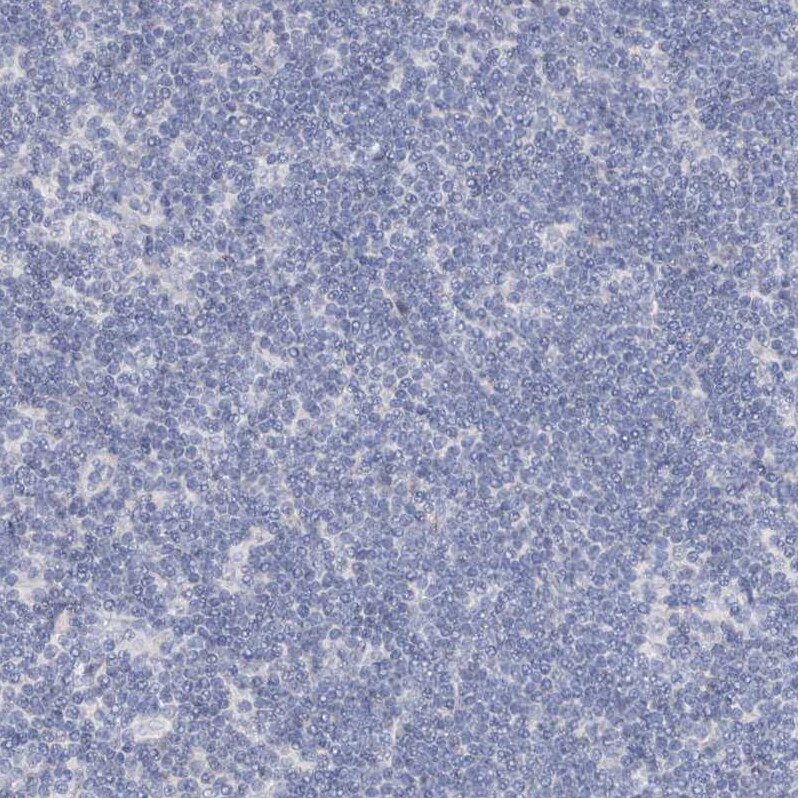 RFX6 Antibody - BSA Free Immunohistochemistry-Paraffin: RFX6 Antibody [NBP2-48677]