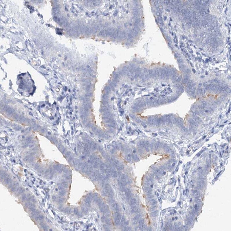RFX6 Antibody - BSA Free Immunohistochemistry-Paraffin: RFX6 Antibody [NBP2-48677]