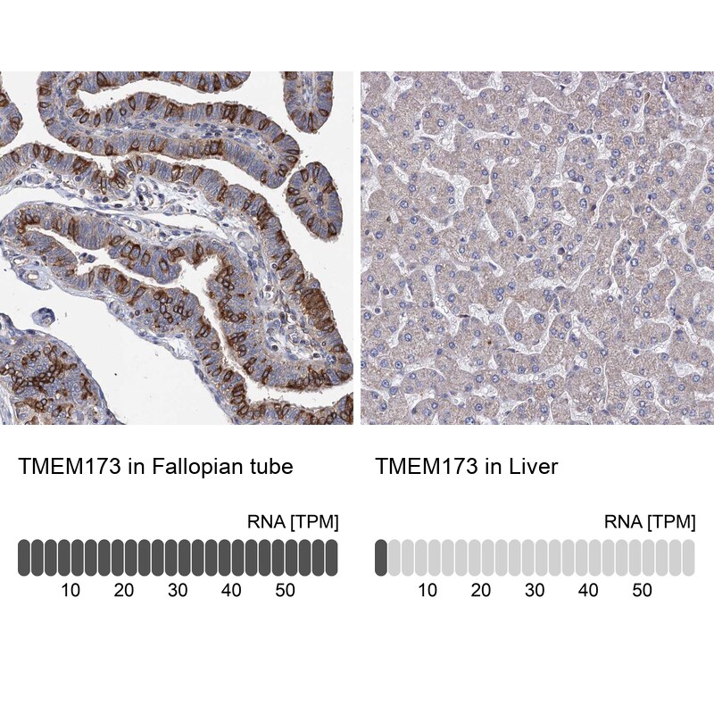 STING/TMEM173 Antibody - BSA Free Immunohistochemistry-Paraffin: STING/TMEM173 Antibody [NBP2-48684]