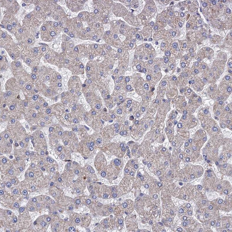STING/TMEM173 Antibody - BSA Free Immunohistochemistry-Paraffin: STING/TMEM173 Antibody [NBP2-48684]